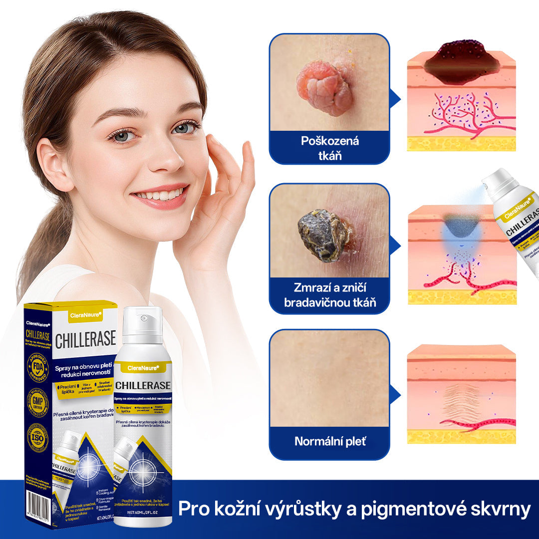 CleraNaure® ChillErase sprej na obnovu hrbolků