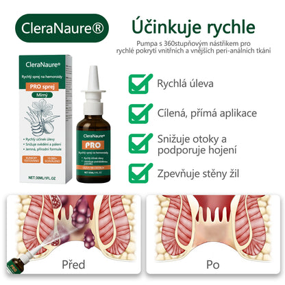 Akce s časovým omezením | CleraNaure® Rychlý Hemoroidní PRO Sprej🎁🎁