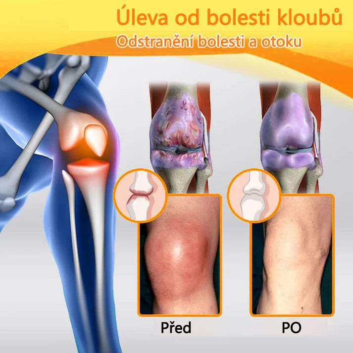 CleraNaure® Krém s včelím jedem pro úlevu od bolesti a hojení kostí 🎉🎉 (speciálně pro seniory)
