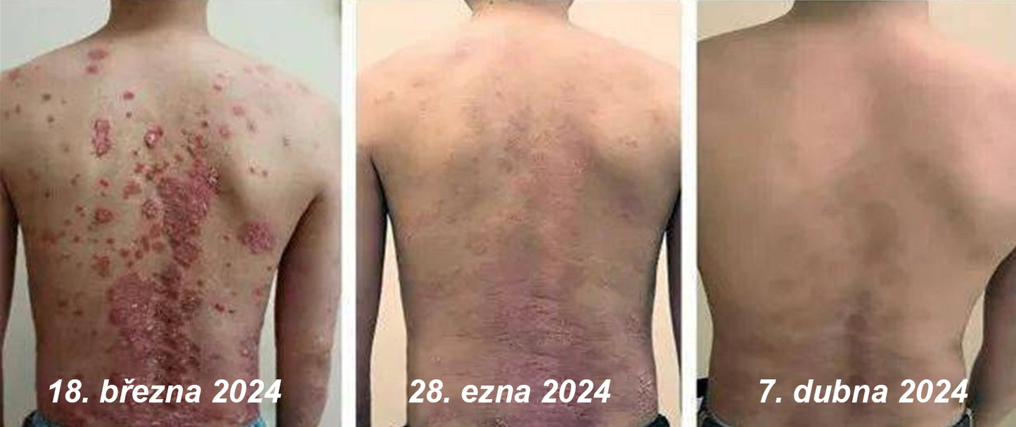 ⚠️🫧CleraNature® Hořčíkový Sprej – Rychlá Úleva pro Svědící, Červenou a Citlivou Pokožku (Dokonce i Intimní Oblasti)