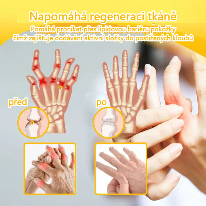 CleraNaure® Krém s včelím jedem pro úlevu od bolesti a hojení kostí 🎉🎉 (speciálně pro seniory)