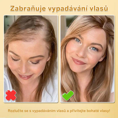 CleraNaure® Biotinový sprej pro růst vlasů (Nové složení)