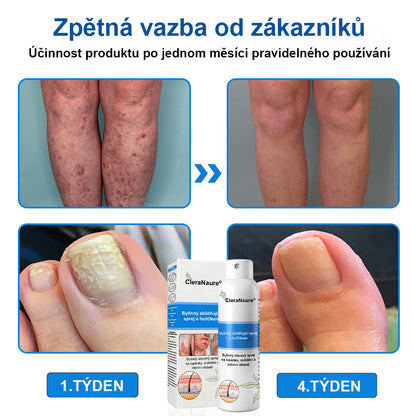 ⚠️🫧CleraNature® Hořčíkový Sprej – Rychlá Úleva pro Svědící, Červenou a Citlivou Pokožku (Dokonce i Intimní Oblasti)