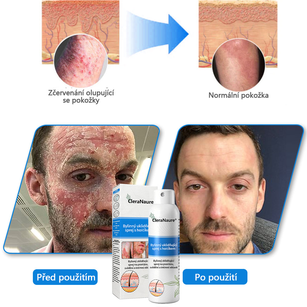 💎CleraNaure® Magnesium bylinný sprej
