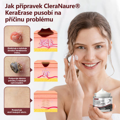 ⭐🔥Oficiální obchod👨‍⚕️ CleraNaure® KeraErase - Krém s dvojitým účinkem pro obnovu pokožky 👨‍⚕️ (Obnova s dvojím účinkem – zjemňuje vyvýšené hrbolky a odbourává hluboké nahromadění keratinu bez kyselin a podráždění)