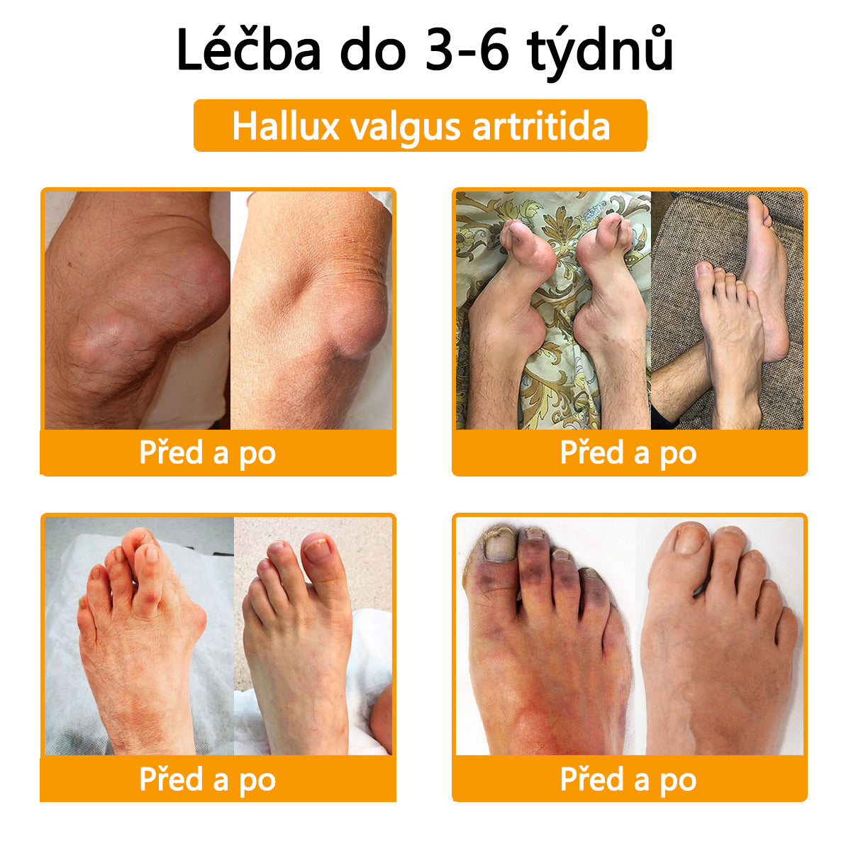 CleraNaure® Krém s včelím jedem pro úlevu od bolesti a hojení kostí 🎉🎉 (speciálně pro seniory)