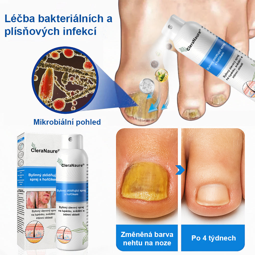 ⚠️🫧CleraNature® Hořčíkový Sprej – Rychlá Úleva pro Svědící, Červenou a Citlivou Pokožku (Dokonce i Intimní Oblasti)