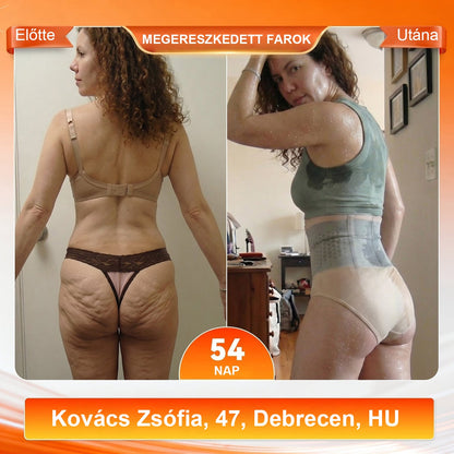 💪 Laleia® 2026 Moringa & Berberine 4 az 1-ben Mikrorészecskés Formáló és Zsírégető Rövidnadrág