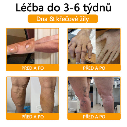 CleraNaure® Krém s včelím jedem pro úlevu od bolesti a hojení kostí 🎉🎉 (speciálně pro seniory)