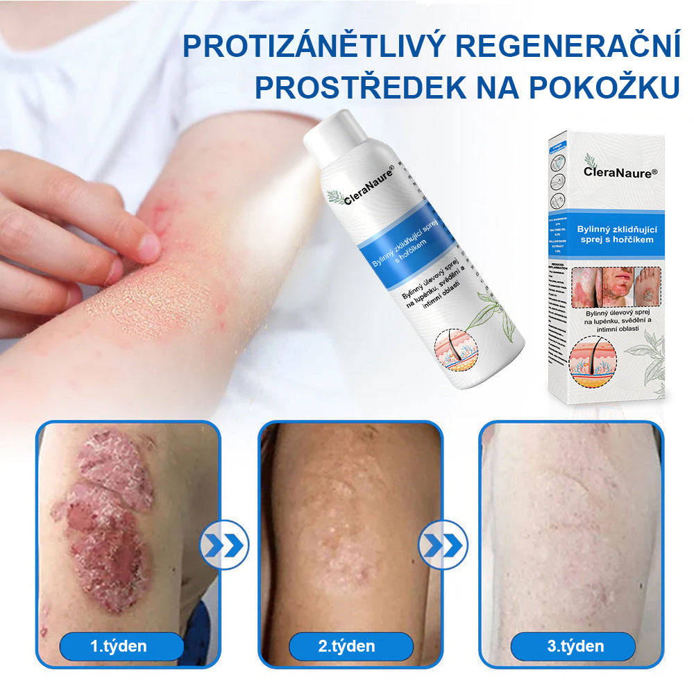 ⚠️🫧CleraNature® Hořčíkový Sprej – Rychlá Úleva pro Svědící, Červenou a Citlivou Pokožku (Dokonce i Intimní Oblasti)