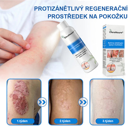 ⚠️🫧CleraNature® Hořčíkový Sprej – Rychlá Úleva pro Svědící, Červenou a Citlivou Pokožku (Dokonce i Intimní Oblasti)