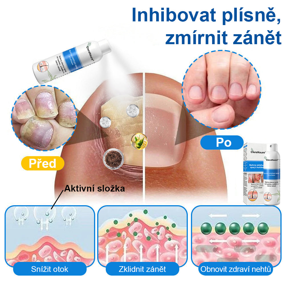 ⚠️🫧CleraNature® Hořčíkový Sprej – Rychlá Úleva pro Svědící, Červenou a Citlivou Pokožku (Dokonce i Intimní Oblasti)