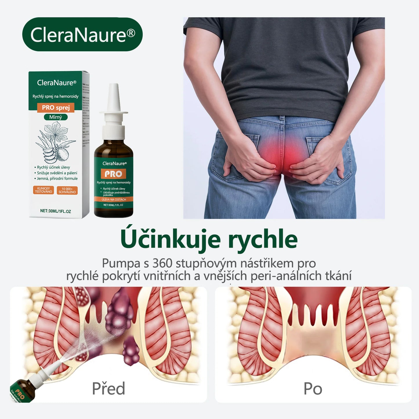 Akce s časovým omezením | CleraNaure® Rychlý Hemoroidní PRO Sprej🎁🎁