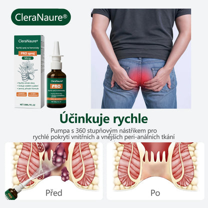 Akce s časovým omezením | CleraNaure® Rychlý Hemoroidní PRO Sprej🎁🎁