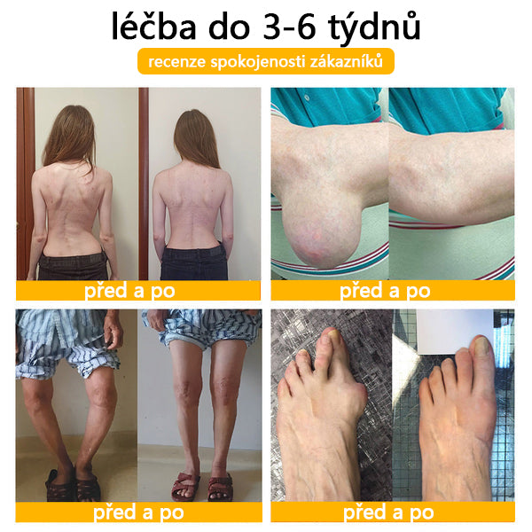 CleraNaure® Krém s včelím jedem pro úlevu od bolesti a hojení kostí 🎉🎉 (speciálně pro seniory)