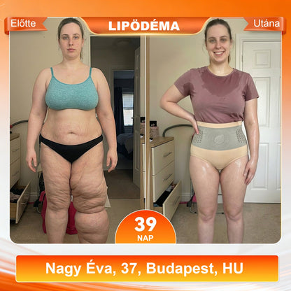 💪 Laleia® 2026 Moringa & Berberine 4 az 1-ben Mikrorészecskés Formáló és Zsírégető Rövidnadrág