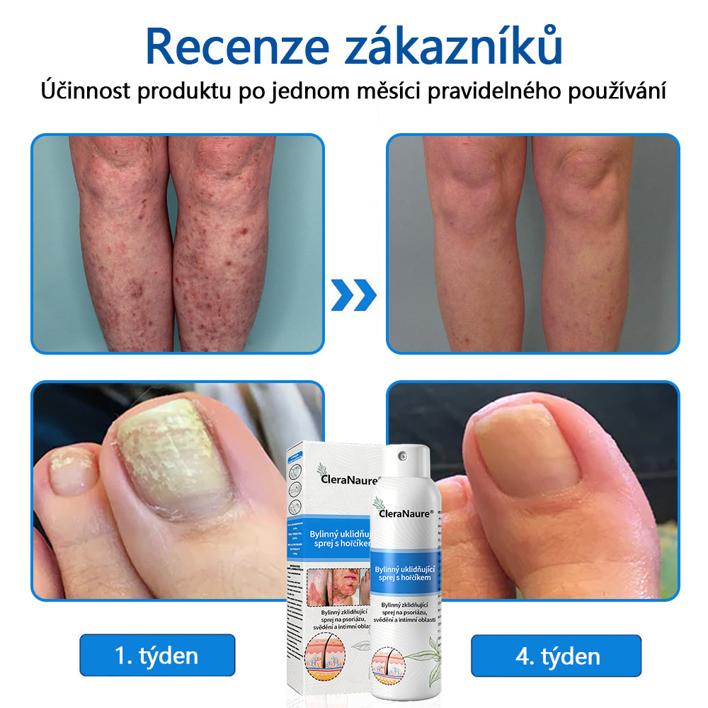 💎CleraNaure® Magnesium bylinný sprej