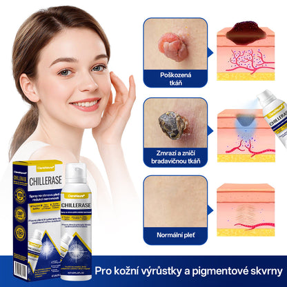 CleraNaure® ChillErase sprej na obnovu hrbolků