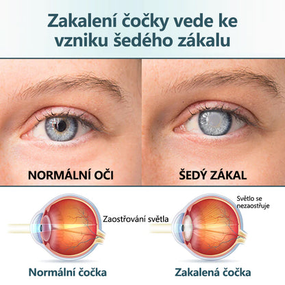 CleraNaure® Optifusion Nano Kapky pro Oči Sérum-Nanotechnologie obnovuje jasné vidění, bez brýlí, bez chirurgického zásahu