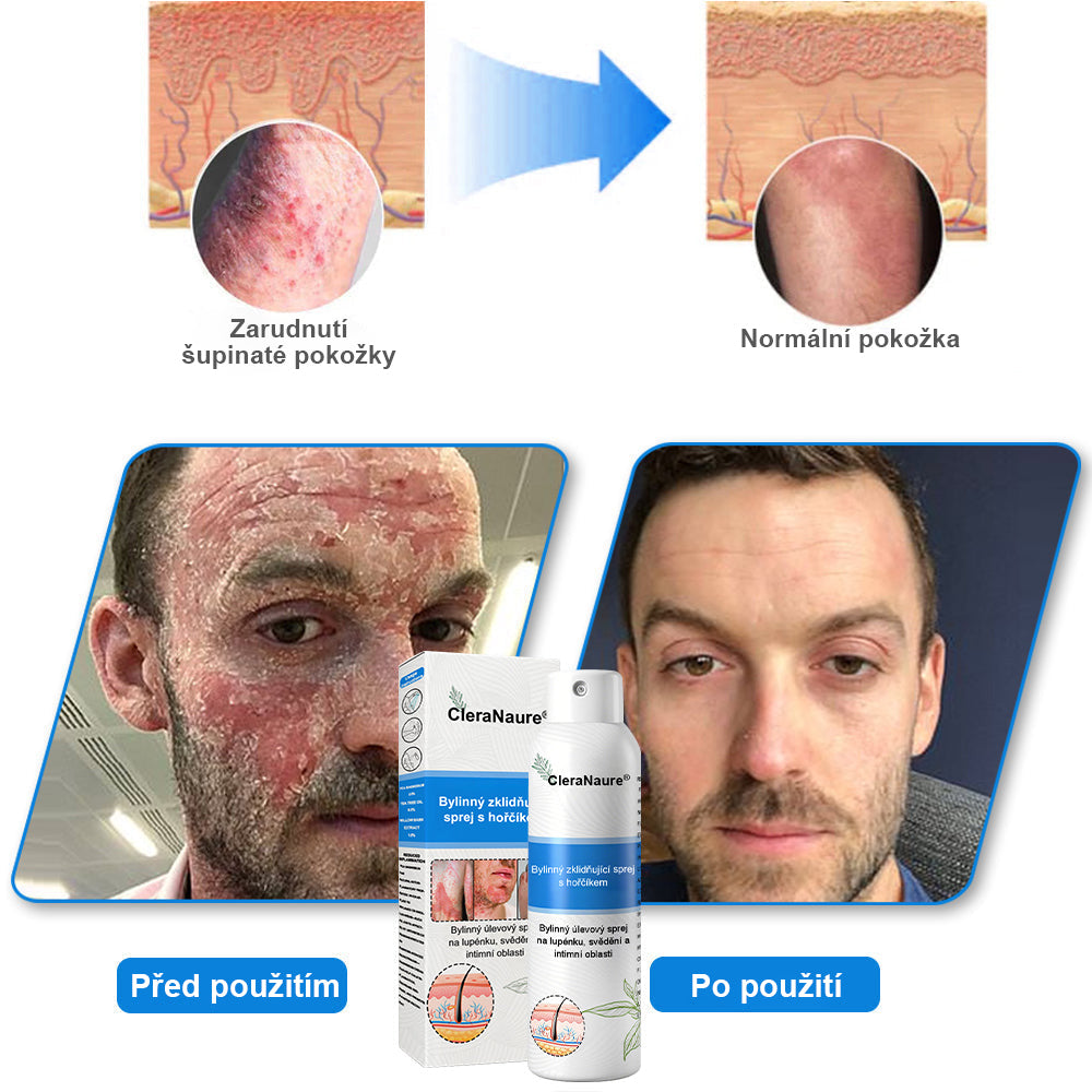 ⚠️🫧CleraNature® Hořčíkový Sprej – Rychlá Úleva pro Svědící, Červenou a Citlivou Pokožku (Dokonce i Intimní Oblasti)