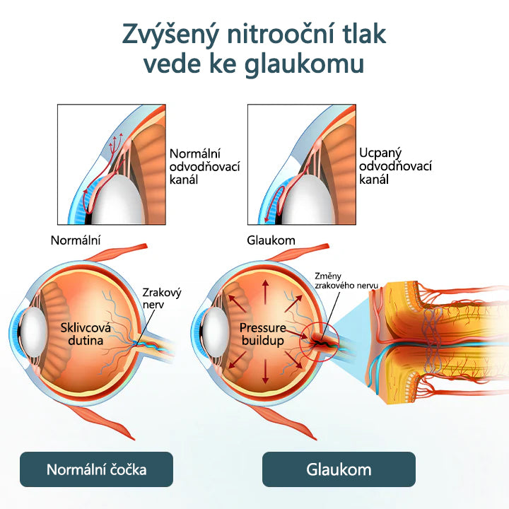CleraNaure® Optifusion Nano Kapky pro Oči Sérum-Nanotechnologie obnovuje jasné vidění, bez brýlí, bez chirurgického zásahu