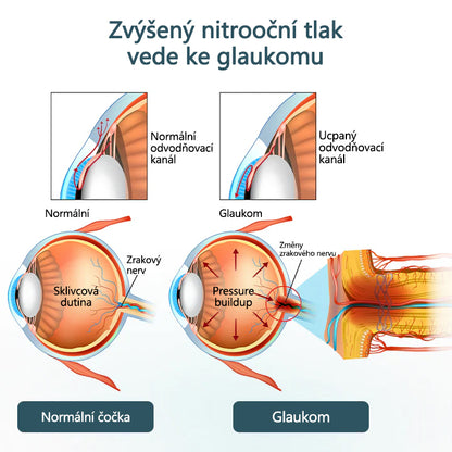 CleraNaure® Optifusion Nano Kapky pro Oči Sérum-Nanotechnologie obnovuje jasné vidění, bez brýlí, bez chirurgického zásahu