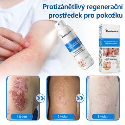💎CleraNaure® Magnesium bylinný sprej