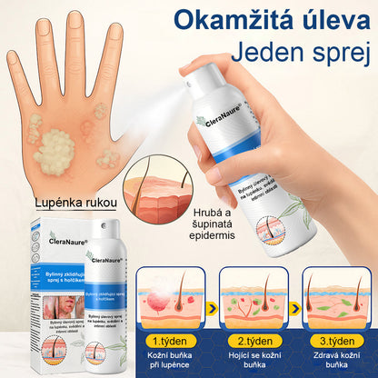 ⚠️🫧CleraNature® Hořčíkový Sprej – Rychlá Úleva pro Svědící, Červenou a Citlivou Pokožku (Dokonce i Intimní Oblasti)